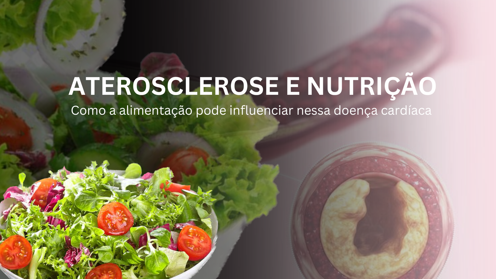 A aterosclerose é uma doença cardiovascular crônica que ocorre devido ao acúmulo de placas de gordura nas paredes das artérias...